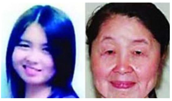 妙齡少女一夜變老，老公不離不棄，這才是真愛，整容手術讓她重生