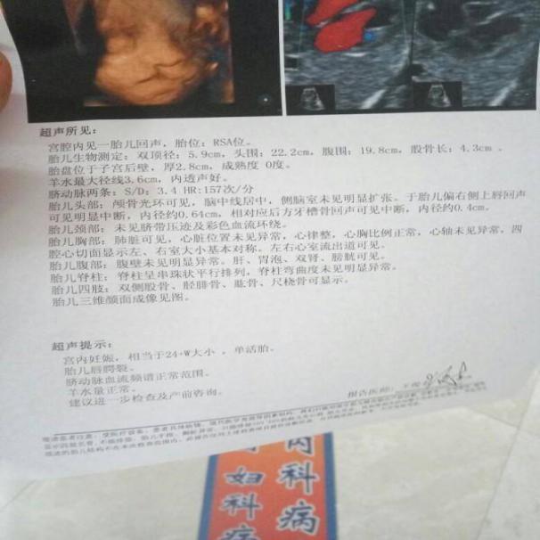 產檢胎兒是兔唇，媽媽堅持把他生下，幾個月後孩子變化令人驚喜