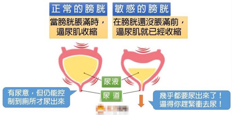 小孩夜尿，怎麼戒晚上尿布？三個方法教給你