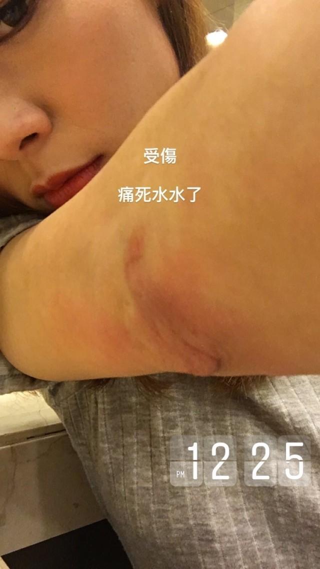 失婚又失平衡！TVB「熊若水」拍劇出意外：好在沒斷骨！