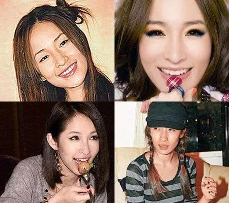 變臉天后蕭亞軒整容失敗...！近照曝光已是面目全非，不忍直視！！