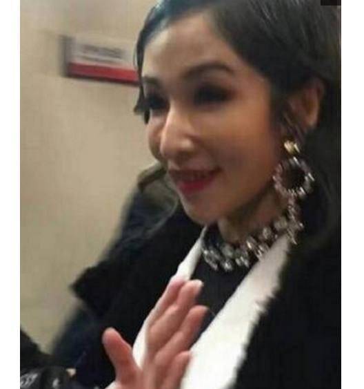 39歲天后蕭亞軒整容崩顏....! 如今面目全非不敢認 !!