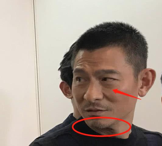 劉德華真的老了！近照曝光他瘦成這樣，一場大病讓他蒼老了10歲~~~