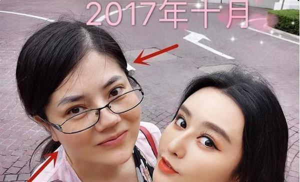 42歲阿姨太瘋狂！花巨資整成迪麗熱巴，只用了15天的時間!