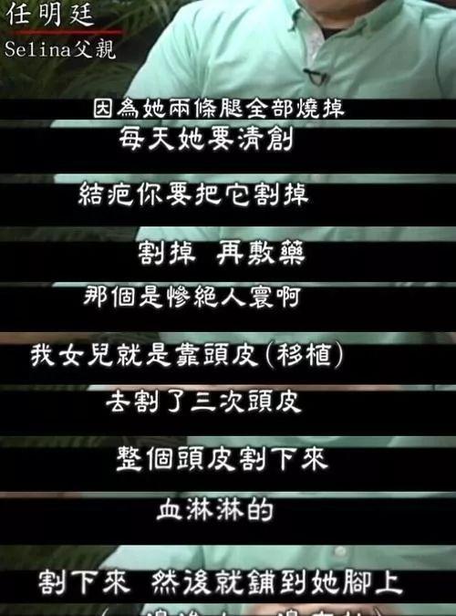 Selina前夫稱見到她的傷處就想吐，用十年看清一個渣男到底虧不虧 ?！