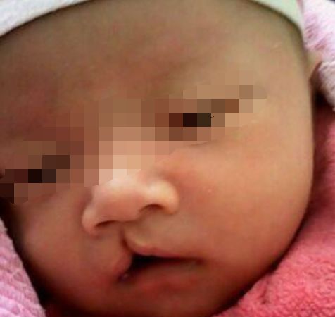  25歲女子連生三胎都是兔唇，醫生查出真相，女子怒打婆婆！