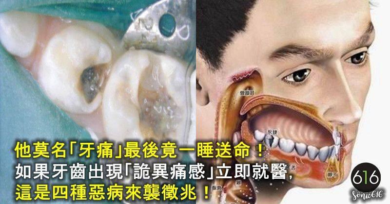 他莫名「牙痛」最後竟一睡送命！如果牙齒出現「詭異痛感」立即就醫！這是四種惡病來襲徵兆！