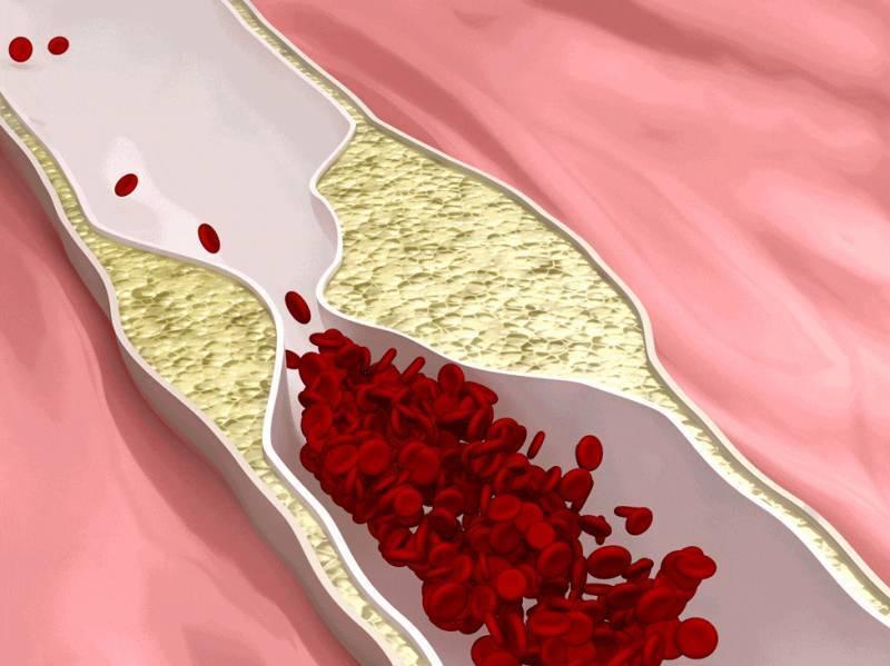 45歲以後的人要注意，這10種食物號稱疏通血管的「高手」，隨便記住兩種你都賺了！