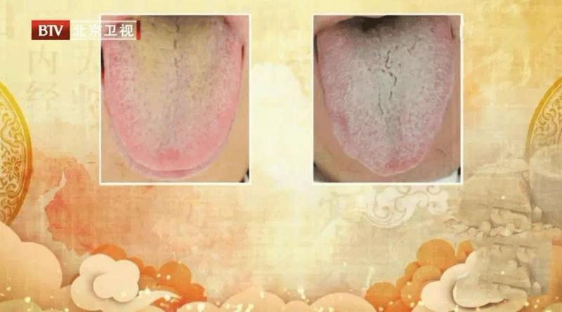 薏米祛濕又消腫？一個步驟錯了，當心濕氣越來越重！