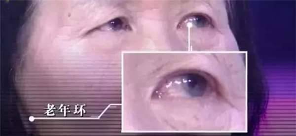 鏡子是半個醫生，照出身上有「這個」千萬別猶豫，馬上去醫院就對了！ -