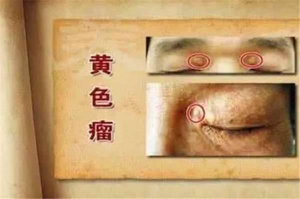 鏡子是半個醫生，照出身上有「這個」千萬別猶豫，馬上去醫院就對了！ -