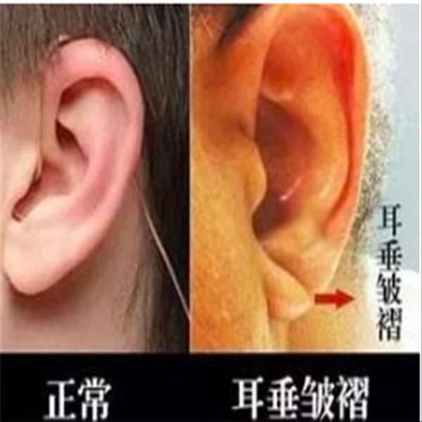 鏡子是半個醫生，照出身上有「這個」千萬別猶豫，馬上去醫院就對了！ -
