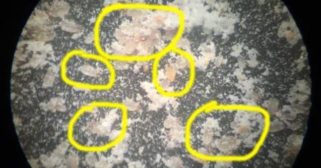 床上的蟎蟲，沒太陽曬怎麼辦？教你一招，不用曬就能消滅蟎蟲，方法簡單還省錢！！