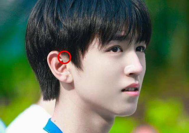 孩子生下來耳朵上就有小孔？不是福氣，爸媽要心裡有數，不容忽視
