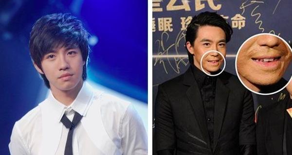 顏值回歸了！當年與Selina一起被燒傷，8年後俞灝明"燒傷臉"近照曝光！網民：依然帥氣！