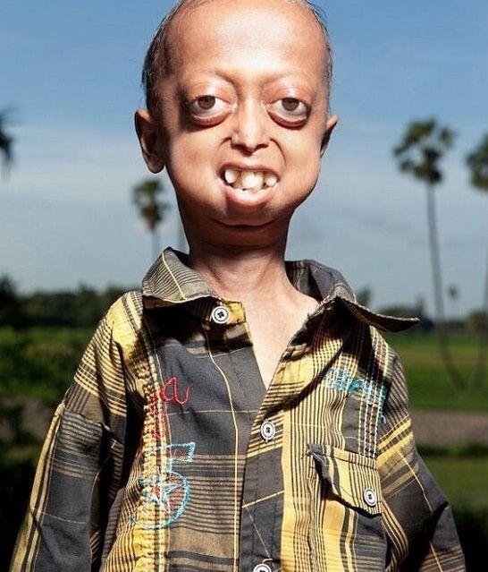 一對夫婦成婚後生下的孩子，個個跟外星人似的，醫生大罵：無知