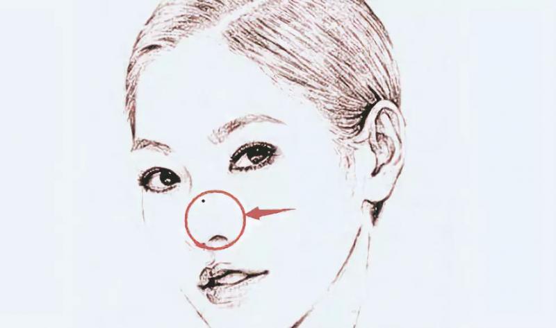 女人臉上5大吉痣，吃得好，穿得好，嫁得好 
