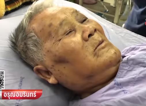 太夭壽！85歲高齡老翁慘遭數百蜜蜂圍攻，「蜂針像一顆顆白白粉刺」布滿臉超驚悚！ 