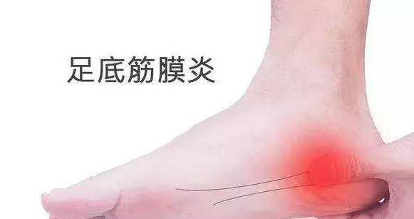 走路腳跟疼，像踩到釘子一樣疼？教你4招，迅速止疼，遠離足底筋膜炎