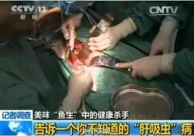 5個「肝臟殺手」，最隱蔽的一個不是熬夜、喝酒，藏得太深了
