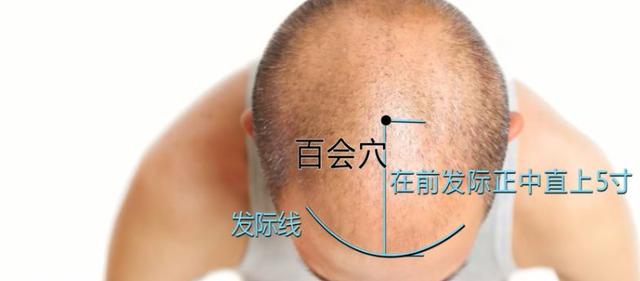 做3道題，測試是否有老年癡呆，結果出來也不怕，4個方法能預防