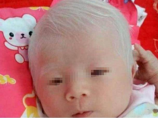 一對夫婦在垃圾堆里撿到一個白髮嬰兒，抱去醫院後，夫婦樂開了花