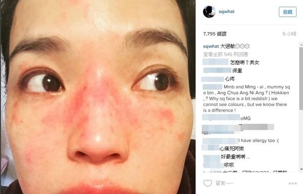 舒淇真的慘！發文暫告演藝圈，4個月沒工作，近照曝光，網友：整張臉太恐怖了。。