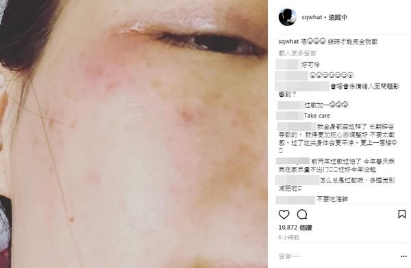 舒淇真的慘！發文暫告演藝圈，4個月沒工作，近照曝光，網友：整張臉太恐怖了。。