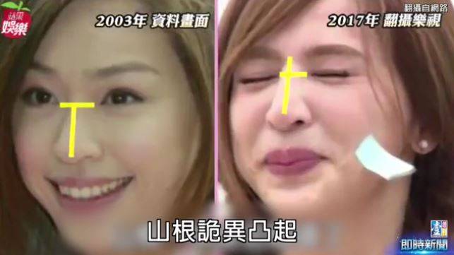 盤點7位當紅女明星「驚人變臉對比照」 有沒有動過…看山根就知道