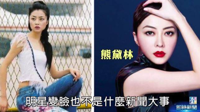 盤點7位當紅女明星「驚人變臉對比照」 有沒有動過…看山根就知道