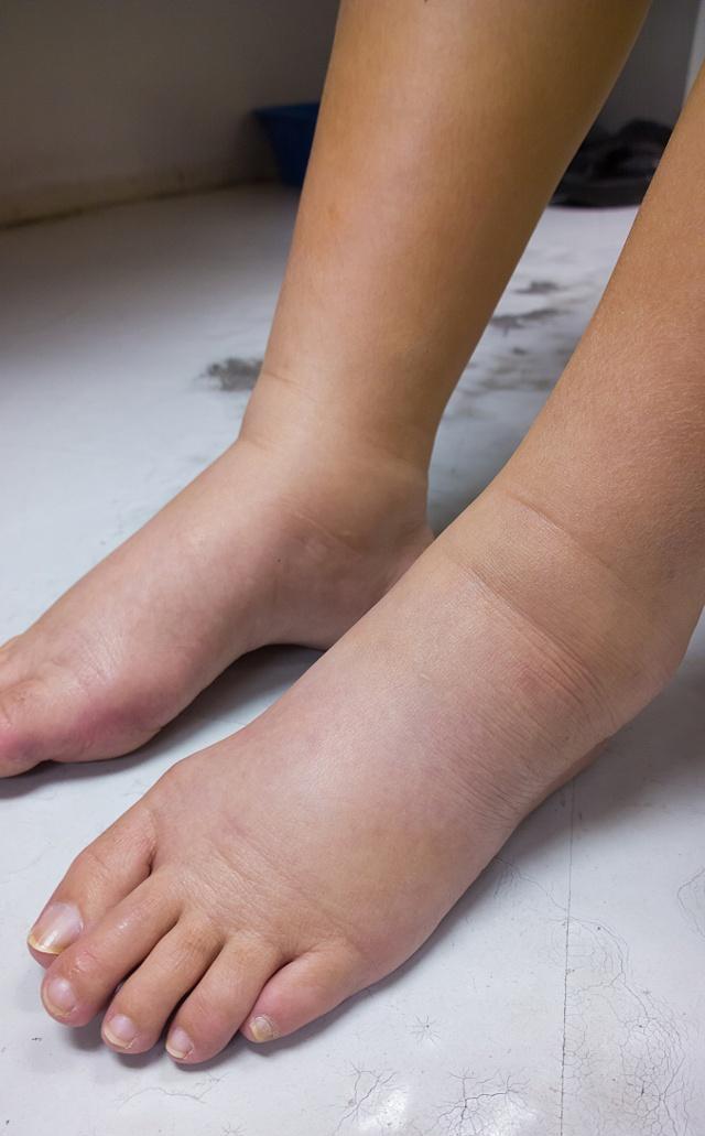 每天睡前靠牆抬腿15分鐘，1個月後，身體會收穫4件好事