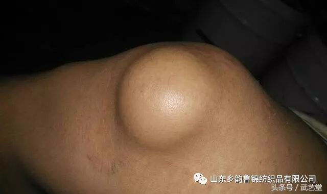 膝蓋疼、膝蓋響，一把香菜加生薑，膝蓋再也不疼了