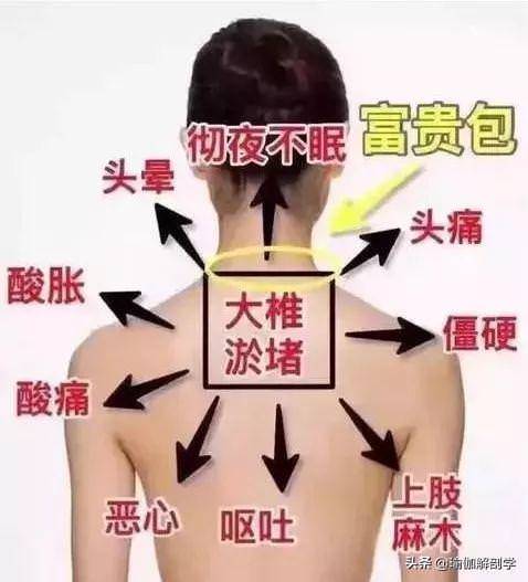 脖子粗背厚，越來越胖？這是經絡不通，用陰瑜伽這樣來拉伸...!