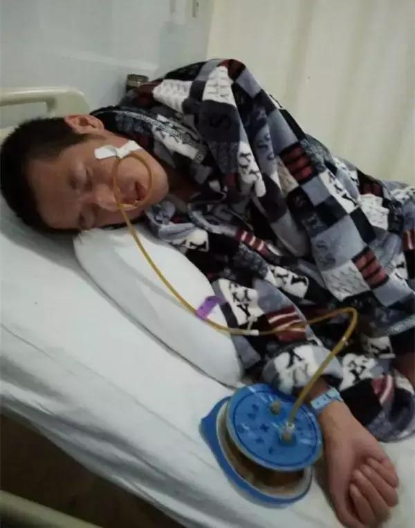 20歲小伙便血入院，查出直腸癌，醫生：這種「息肉」小心癌變