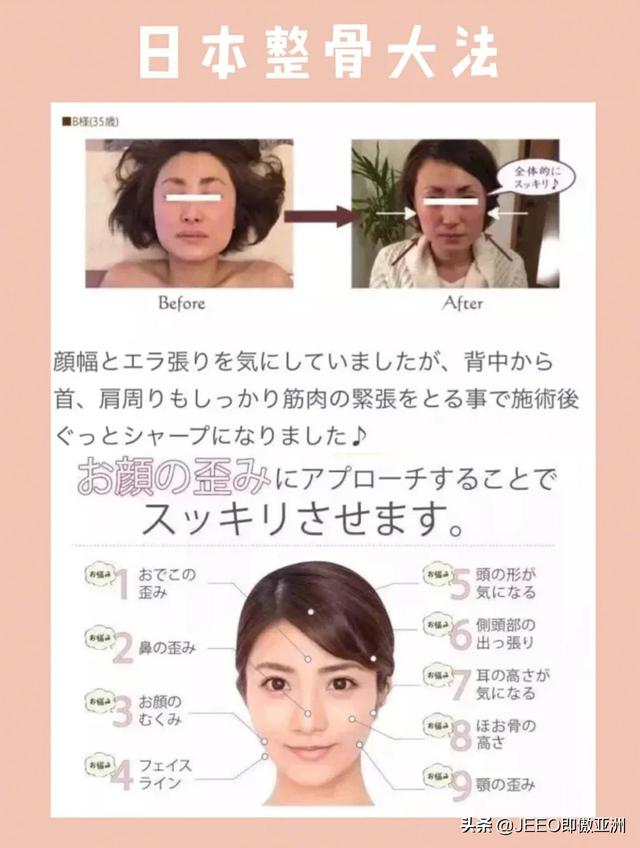每日即傲一招——解密日本整骨v臉手法