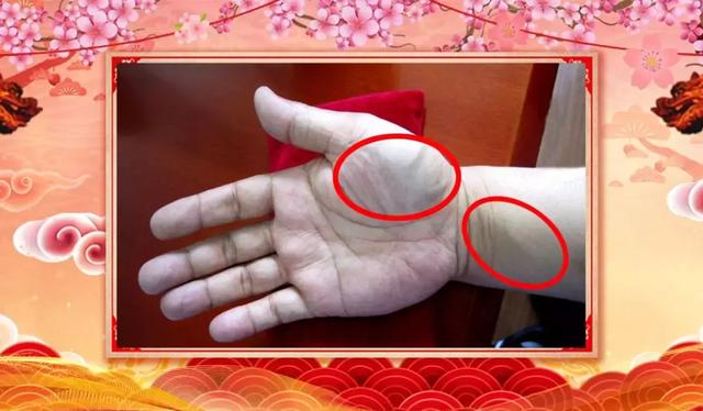 心臟狀況手上看出來！兩個方子通絡降脂、祛火潤燥，清除健康隱患