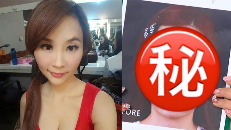 許聖梅爆整型臉毀了！ 崩潰下一病人慘死手術台