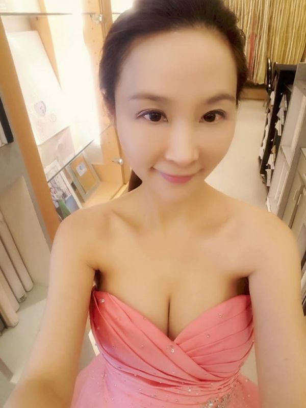 許聖梅爆整型臉毀了！ 崩潰下一病人慘死手術台