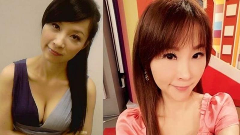 許聖梅爆整型臉毀了！ 崩潰下一病人慘死手術台