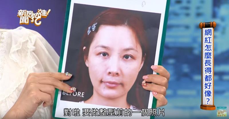 許聖梅爆整型臉毀了！ 崩潰下一病人慘死手術台