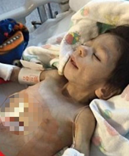  7歲男童瘦到只剩3公斤，被善心夫妻收養，1年後變得像天使一樣美！