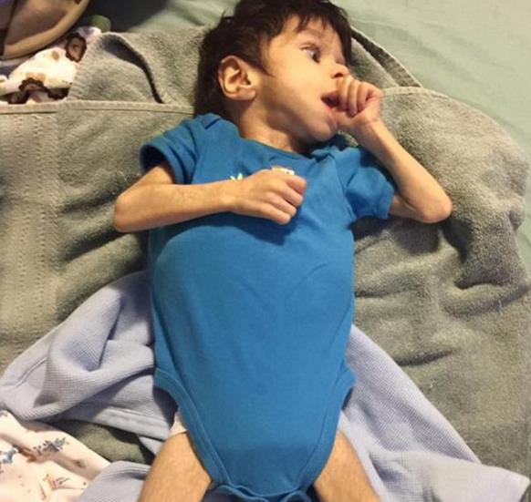  7歲男童瘦到只剩3公斤，被善心夫妻收養，1年後變得像天使一樣美！