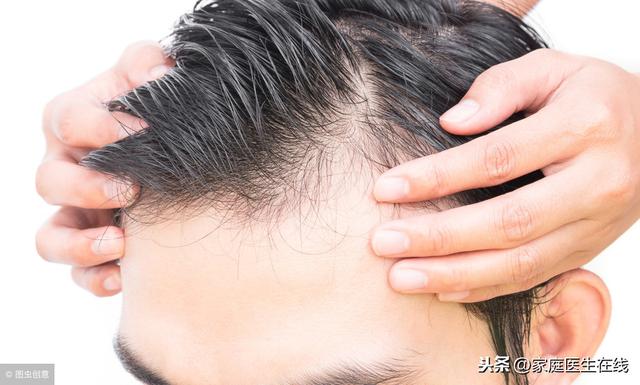 頭髮一天不洗就很油？改掉6件事，還你清爽頭髮！
