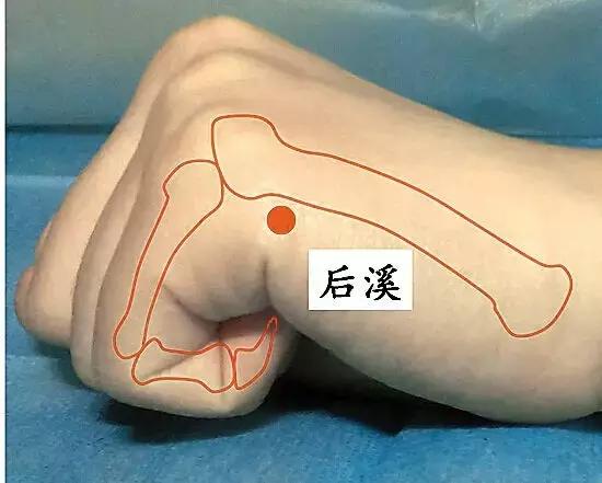 小方法解決大問題！幾種小病痛的按摩治療方法請惠存！