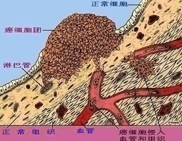 喂養癌細胞？專家：「4類饅頭」多吃一口癌近一步，別再買回家了！