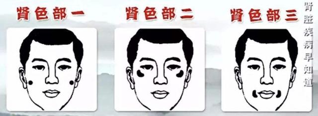 老中醫教你從臉色看自身疾病，多注意