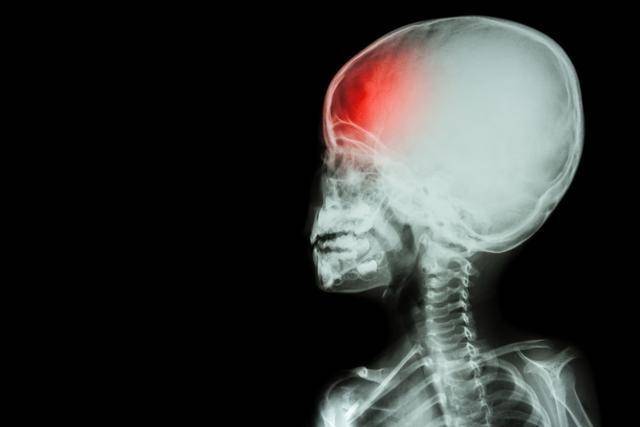 中風為何越來越多？醫生苦勸：這3件事危害很大，很多人卻還在做