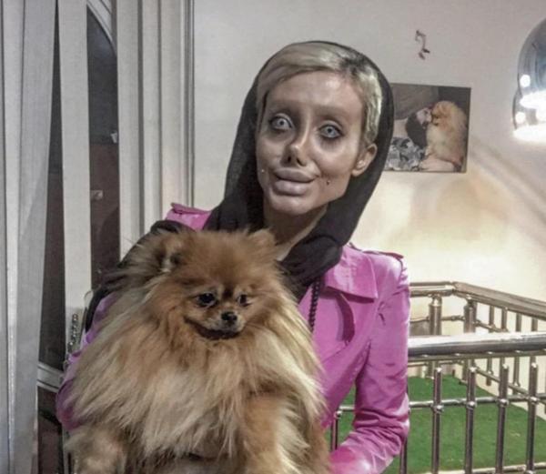 她為變安潔麗娜·裘莉整容50次，網友卻被嚇瘋：像僵屍新娘！！