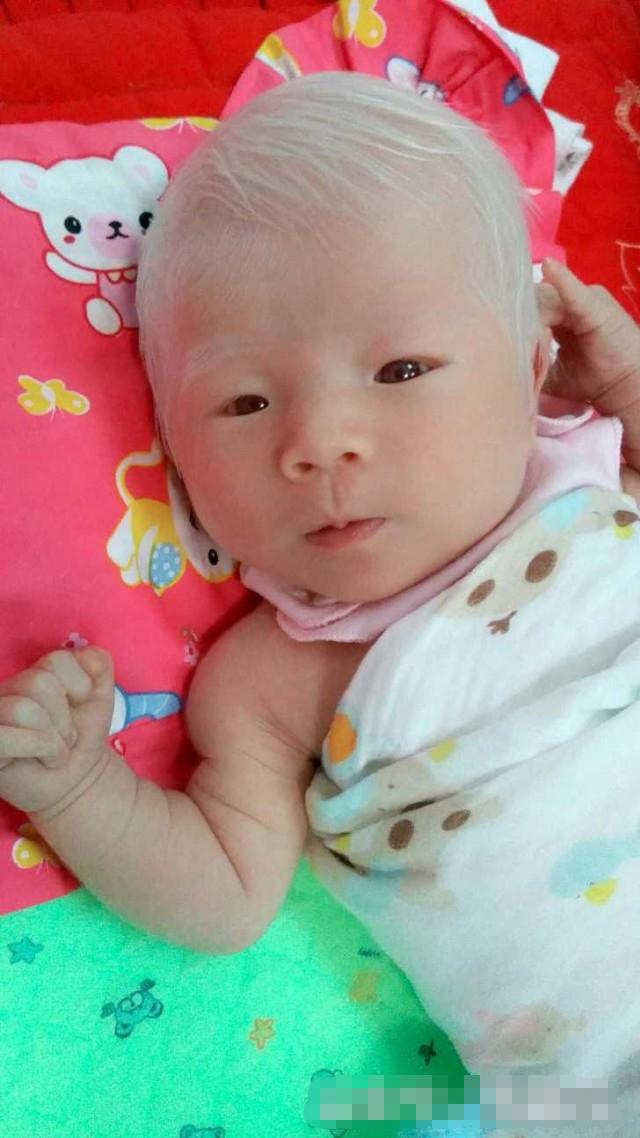 剛出生的女兒「一頭白髮」，漂亮至極！但醫生的「一番話」卻讓媽媽陷入了深深地痛苦之中！！