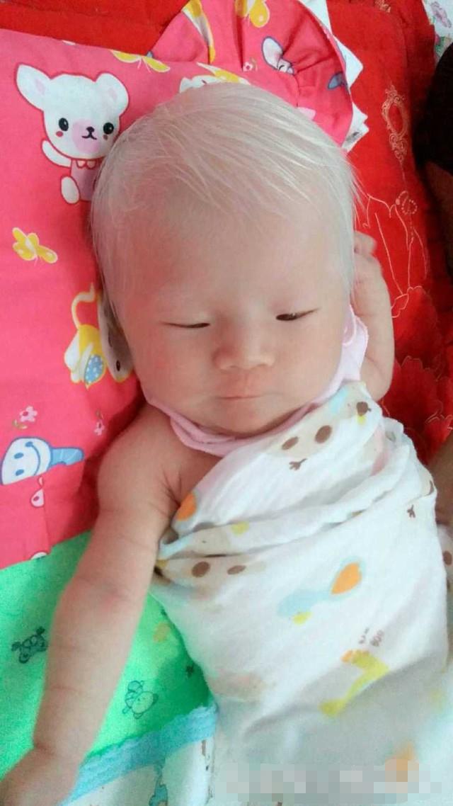剛出生的女兒「一頭白髮」，漂亮至極！但醫生的「一番話」卻讓媽媽陷入了深深地痛苦之中！！